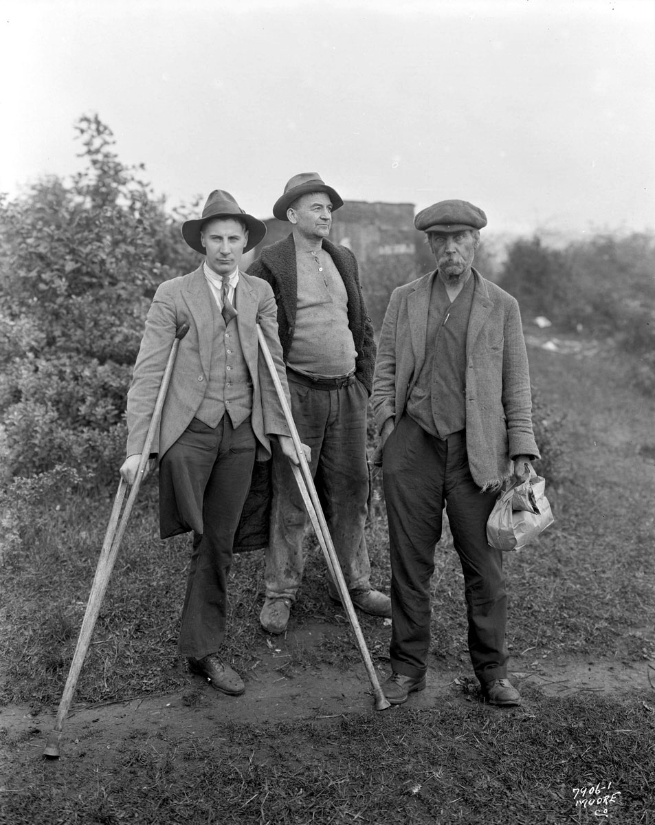 Black and white photo of three men posing for a photo one is on cruches with a missing leg.